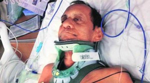 Sureshbhai Patel suffered  a fused vertebrae in a police beating that occurred while he was walking in a White neighborhood. Credit: al.com