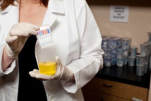 The urine tests so beloved by Theocratic Rightists. Credit: Shutterstock