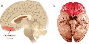 orbitofrontal cortex 