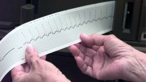 How old is your heart? Probably older than you think, according to a new CDC study that calculates the average "heart age" of American adults. Credit: Kari Rene Hall / Los Angeles Times