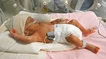 Premature newborn