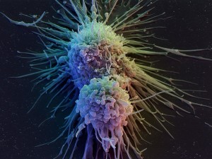 Lymphoblast cells eventually become lymphocytes, cells that are responsible for fighting infection, such as T-Cells Corbis