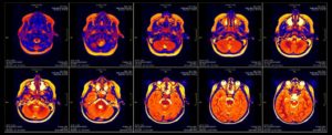 fMRI scans Credit: Shutterstock